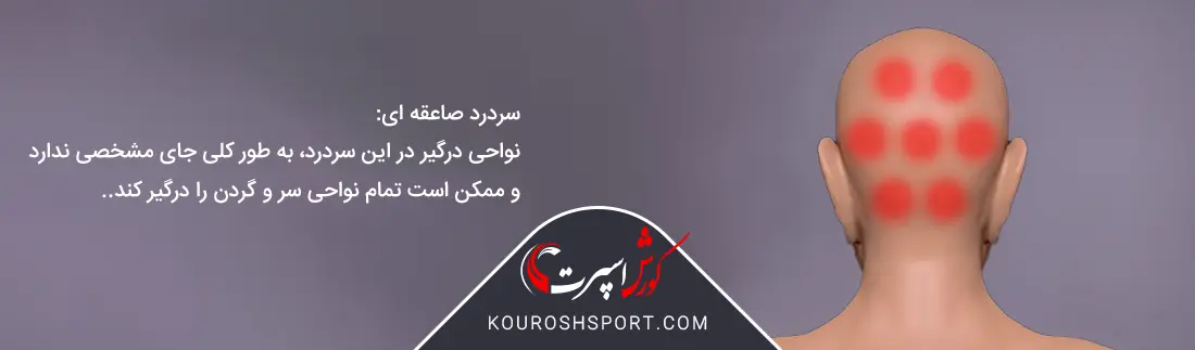تصویر نواحی سردرد صاعقه ای
